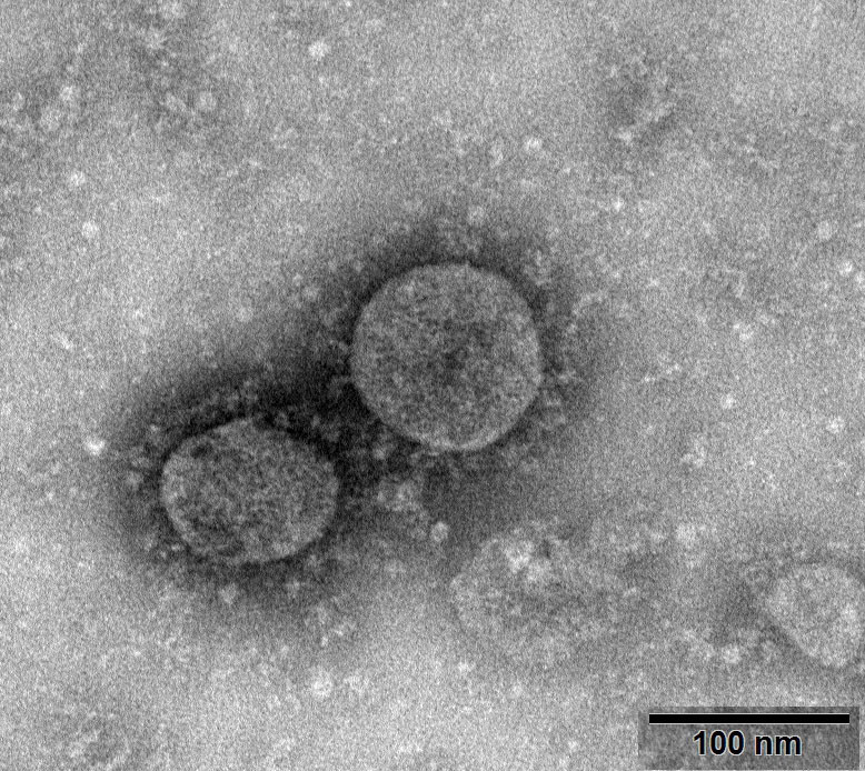 W020200127417305730682 - coronavirus.jpg