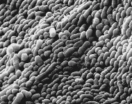 influenzae.gif