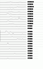 ibis63.gif
