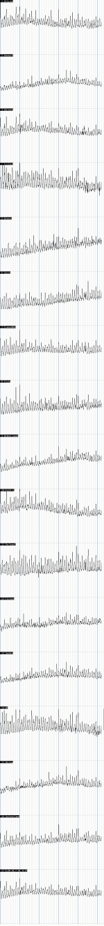 eude2011.gif