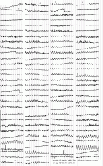 icd10-8.GIF