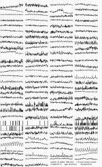 icd10-m.GIF