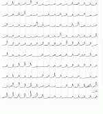 US14209.GIF