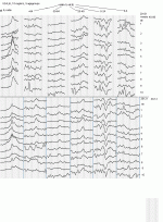 ili1406e.gif