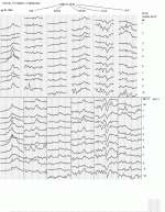 ili1407e.gif