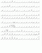 us14223.gif