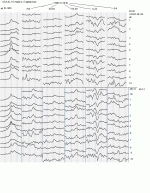 ILI1409E.GIF
