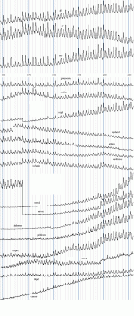 2011A.GIF