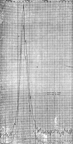 severity of epidemic US Census Bureau graph 1918.jpg