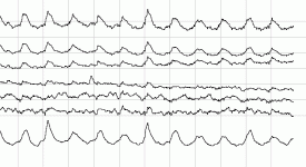 mmwrg3.gif
