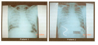 Nipah Fig 2.PNG