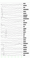 Click image for larger version

Name:	ukra36b.gif
Views:	479
Size:	21.1 KB
ID:	651776