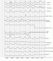 Click image for larger version

Name:	un02.gif
Views:	221
Size:	22.4 KB
ID:	658979