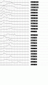 Click image for larger version

Name:	ibis3.gif
Views:	340
Size:	13.3 KB
ID:	660458