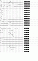 Click image for larger version

Name:	ibis7.gif
Views:	351
Size:	13.3 KB
ID:	660460
