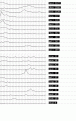Click image for larger version

Name:	ibis81.gif
Views:	337
Size:	12.2 KB
ID:	660461