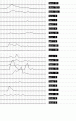 Click image for larger version

Name:	ibis61.gif
Views:	340
Size:	11.6 KB
ID:	660463