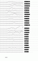 Click image for larger version

Name:	ibis62.gif
Views:	342
Size:	11.8 KB
ID:	660464