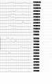 Click image for larger version

Name:	ibis63.gif
Views:	349
Size:	10.8 KB
ID:	660465