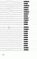 Click image for larger version

Name:	ibis68.gif
Views:	341
Size:	11.3 KB
ID:	660467