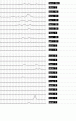 Click image for larger version

Name:	ibis69.gif
Views:	359
Size:	10.4 KB
ID:	660468