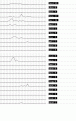 Click image for larger version

Name:	ibis65a.gif
Views:	327
Size:	10.3 KB
ID:	660469