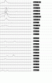 Click image for larger version

Name:	ibis66a.gif
Views:	357
Size:	10.8 KB
ID:	660471