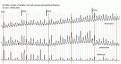 Click image for larger version

Name:	flu59a.gif
Views:	812
Size:	14.0 KB
ID:	660524