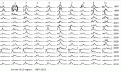 Click image for larger version

Name:	CDC13A.GIF
Views:	178
Size:	12.4 KB
ID:	661244