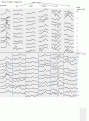 Click image for larger version

Name:	ili1406e.gif
Views:	195
Size:	28.0 KB
ID:	661398