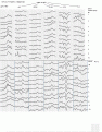 Click image for larger version

Name:	ili1407e.gif
Views:	177
Size:	26.6 KB
ID:	661428