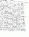 Click image for larger version

Name:	ILI1409E.GIF
Views:	199
Size:	26.8 KB
ID:	661466