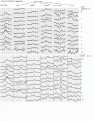 Click image for larger version

Name:	ili1415e.GIF
Views:	232
Size:	29.1 KB
ID:	661604
