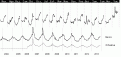 Click image for larger version

Name:	MEX13N17.GIF
Views:	150
Size:	10.2 KB
ID:	668265