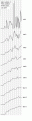 Click image for larger version

Name:	79cs0.GIF
Views:	166
Size:	9.1 KB
ID:	668300